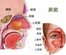 【全國愛鼻日】孩子出現(xiàn)這些癥狀，警惕鼻竇炎！